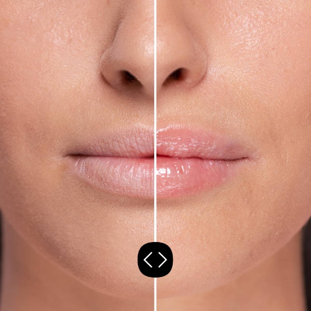 Hyaluronzuur lipvolumizer Freshly 5 ml