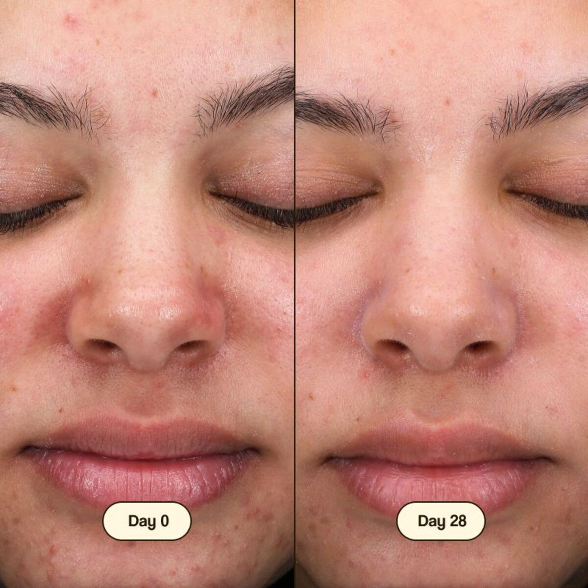 Nettoyant visage Salicylic Fresly 100 ml