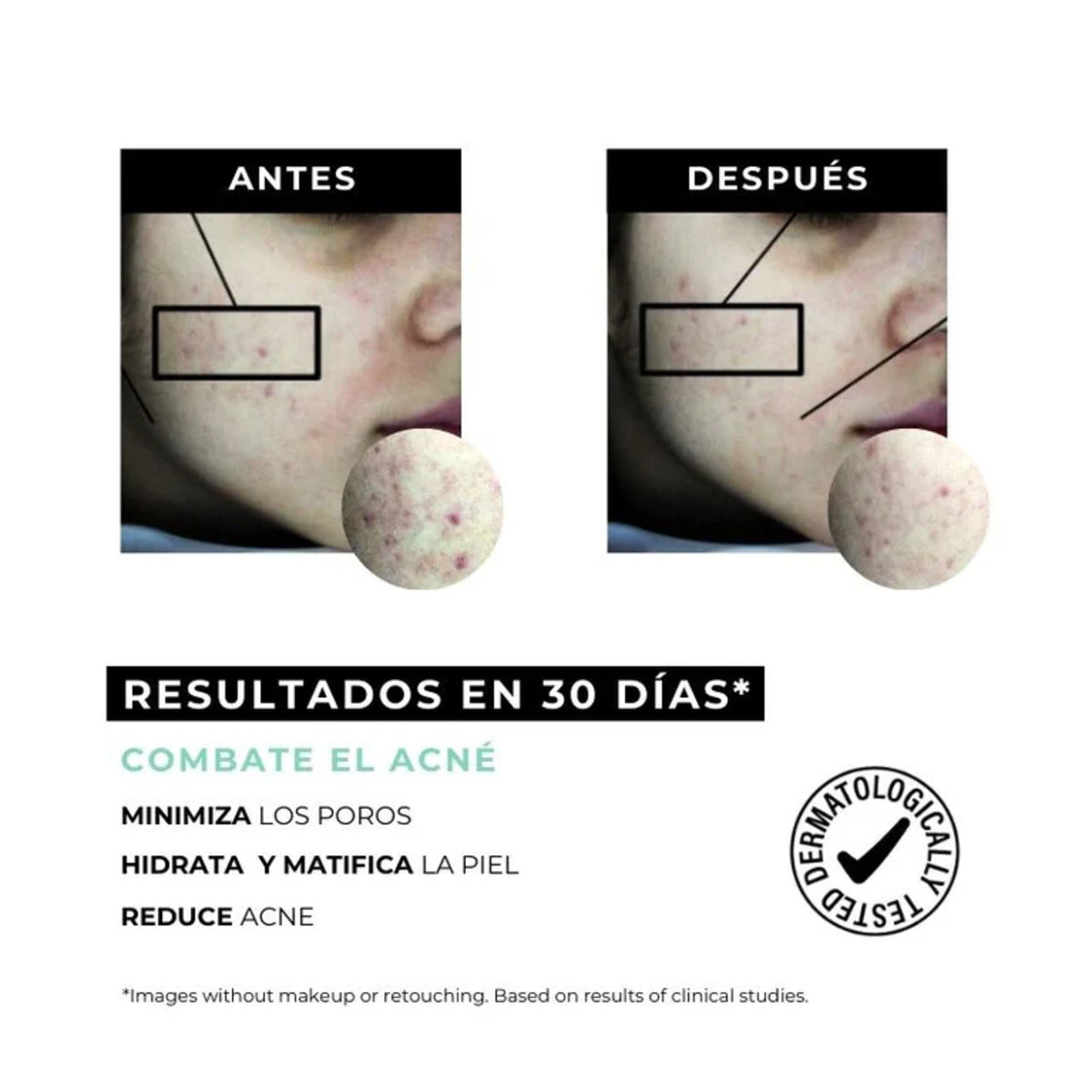 Equilibrium Anti-Akne-Creme für fettige Haut Arganour 30 ml