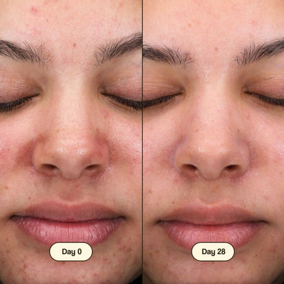 Nettoyant visage Salicylic Fresly 100 ml